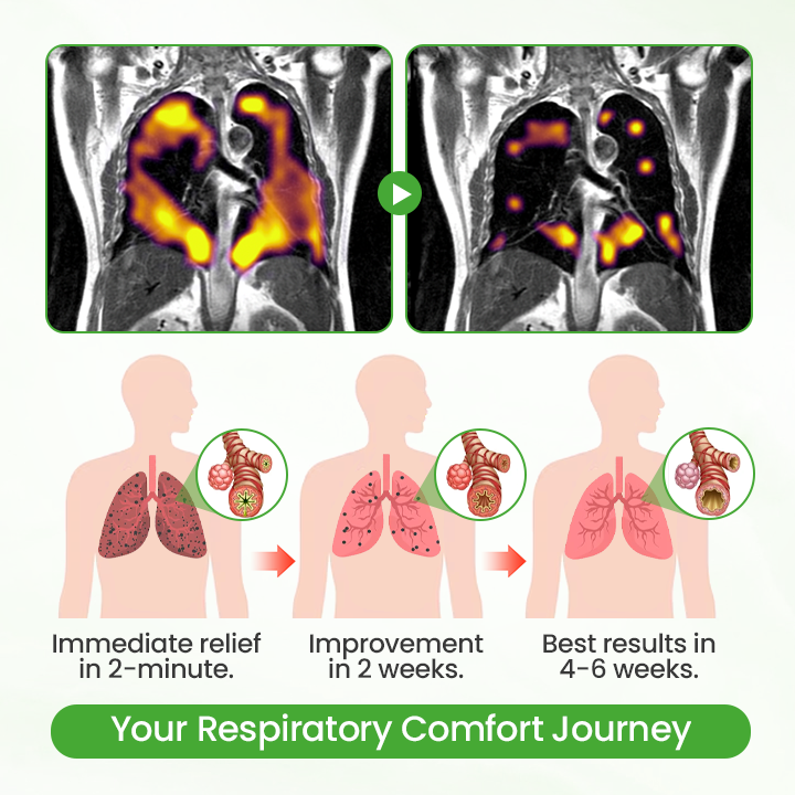 Healvo® HerbaAir Mullein Lung Purifier