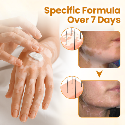 VitiClear Pro Bee Venom Cream