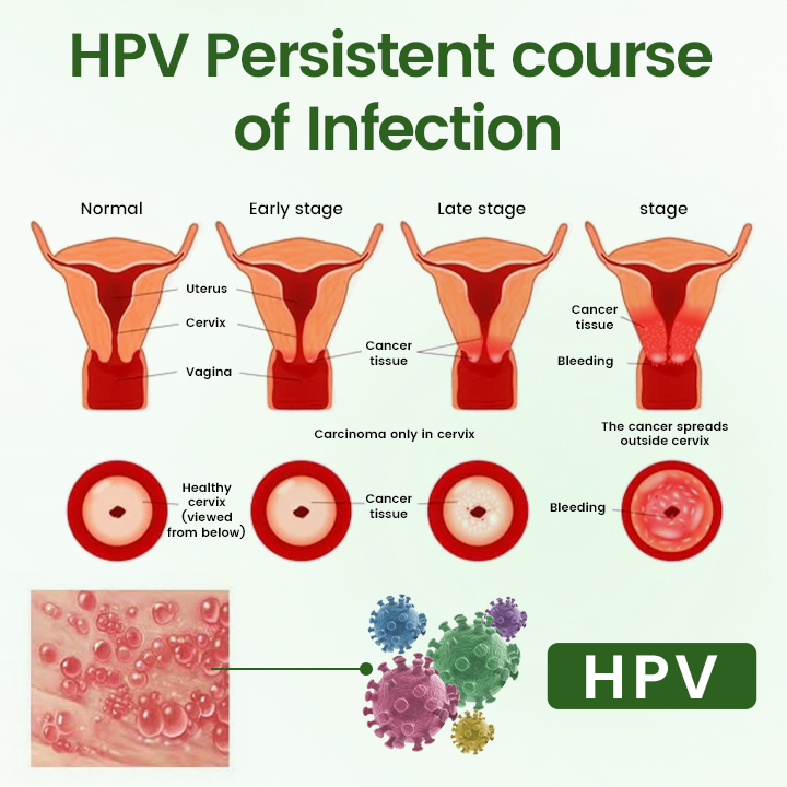 FeminaDefend All-In-One Intimate Therapy Pads