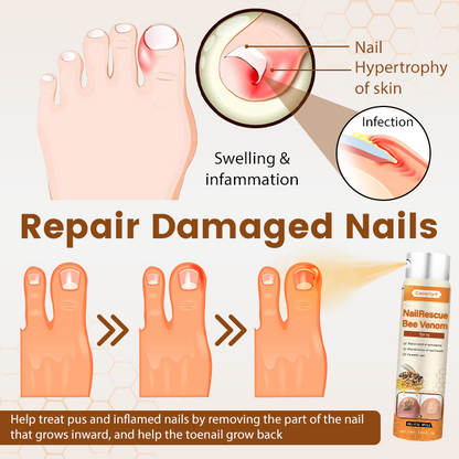 NailRescue Bee Venom Spray