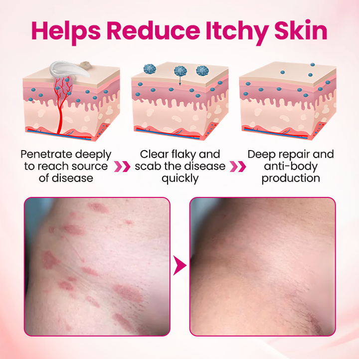 EvaHeal® IntiDefend Anti-HPV Interferon Gel✅