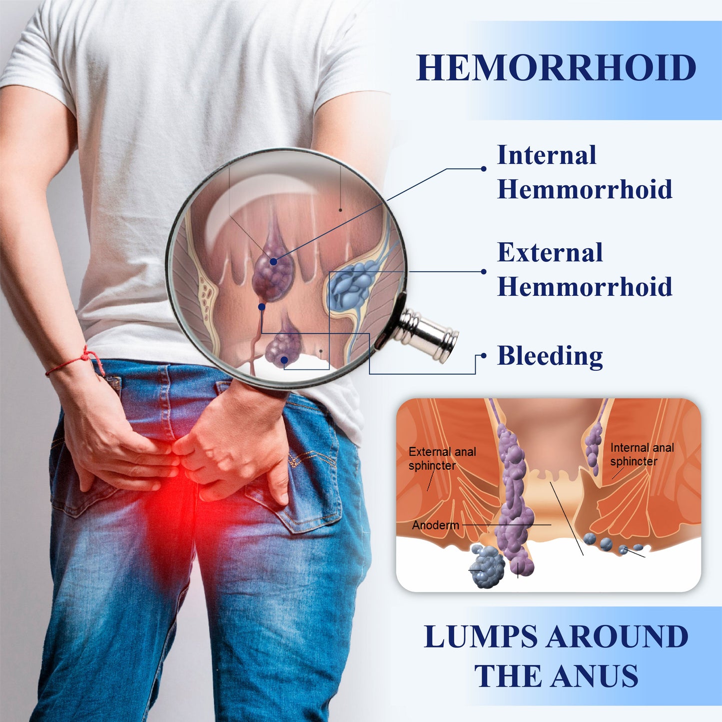 Medical Hemorrhoid Herbal Gel with Applicator