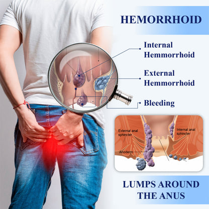 Medical Hemorrhoid Herbal Gel with Applicator
