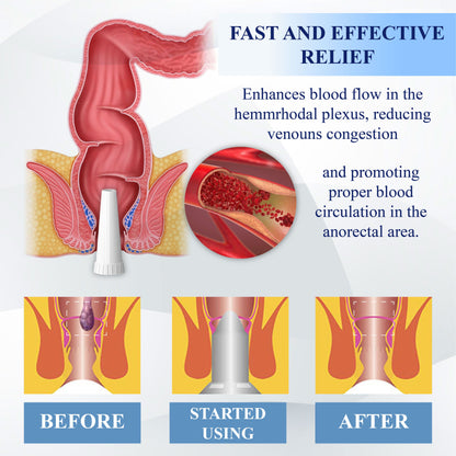 Medical Hemorrhoid Herbal Gel with Applicator