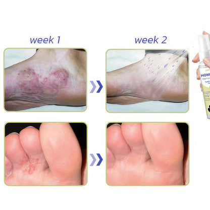 HomeSpa Foot Scrub Spray